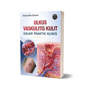 ULKUS VASKULITIS KULIT DALAM PRAKTIK KLINIS